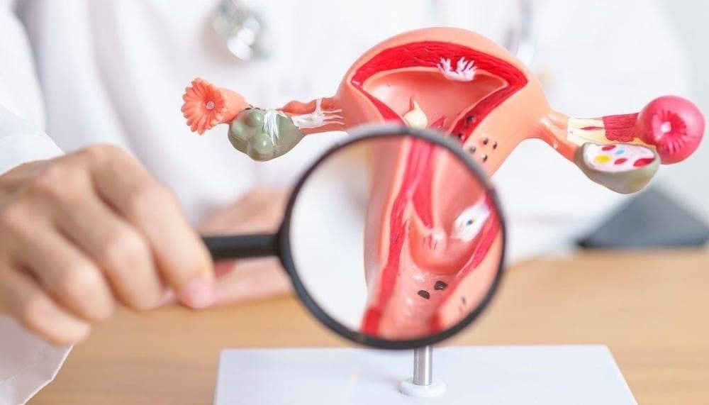 Cervical Cancer Screening for Women 30 to 65 in Ho Chi Minh City