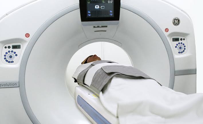 Lung Cancer Screening in Ho Chi Minh City